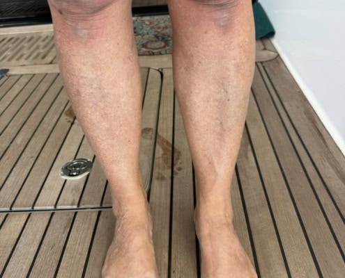 64BECEA4-80F1-48D3-A645-5815A8DC0796_1_105_c